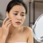 Ilustrasi perawatan kulit wajah. Ahli dermatologi menyebutkan bahwa faktor internal seperti stres dan kurang tidur turut memicu kondisi wajah kusam.